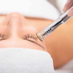 Microdermabrasion treatment