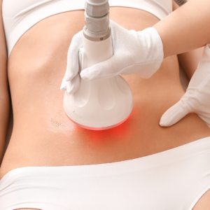 Skin laxity and firming